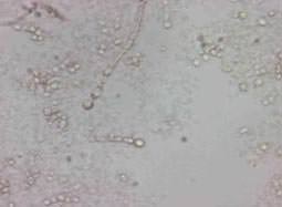 clamidosporas