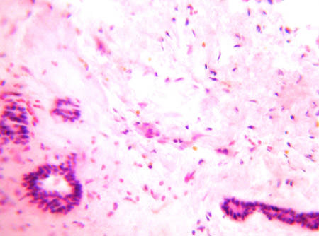Figura 2 Examen anatomo patolológico