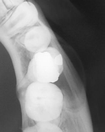 Figura 2 Radiografía oclusal diente 8.5 donde se aprecia la expansión de la cortical ósea vestibular.
