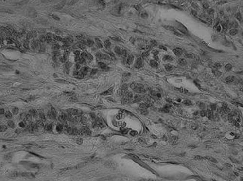 Fig. 6 Restos odontogénicos a mayor aumento (40X) observándose las células epiteliales con detalle.