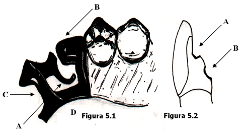 Fig. 5.1 Retenedor Directo A. Brazo retentivo lingual flexible B. Tope en forma de cuña C. Conector menor D. Conector mayor  Fig. 5.2 Preparación de la corona del diente pilar A. Descanso B. Socavado retentivo