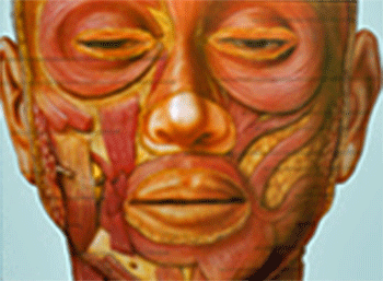 FIGURA 3: Trastornos musculares