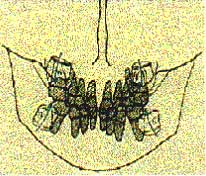 Fig. 3 Dirección Buco-Lingual