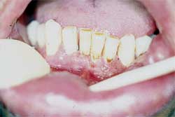 Fig. 1 Cavidad bucal
