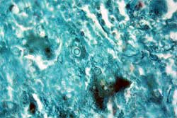 Fig. 4 Histopatologia