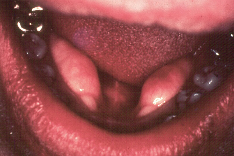 Foto nº 4