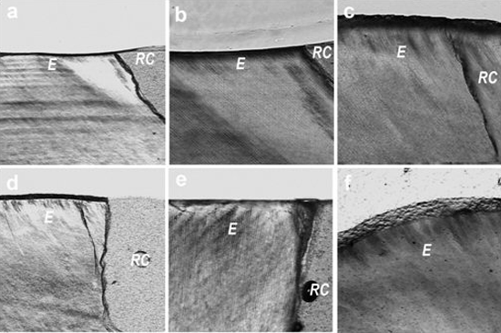Imagen 3. MEB de muestras del tercio cervical. a: PB; b: PD; c: DOA; d: PE; e: FCT; f: Control. En todas las muestras pulidas se eliminó el cemento radicular y fue posible observar dentina (D), determinada por la presencia de túbulos dentinarios cortados en forma transversal. En la muestra f se observa cemento (Cem) sobre la superficie radicular. RC: resina.