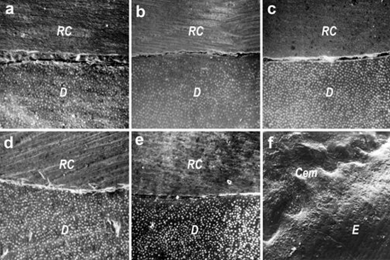 Imagen 4. MO de muestras del tercio cervical. a: PB; b: PD; c: DOA; d: PE; e: FCT; f: Control. En las muestras a, b, c, d se eliminó el cemento radicular. En una de las muestras pulidas con fresa multicuchillo (e1) se encontró cemento (Cem) sobre la superficie. En la otra (e2) se observaron las marcas del extremo activo de la fresa sobre la superficie radicular. En la muestra f es posible observar cemento y bajo él la zona granulosa de Thomes. D: dentina; RC: resina; Cem: cemento.