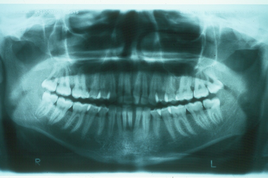 Figura 2