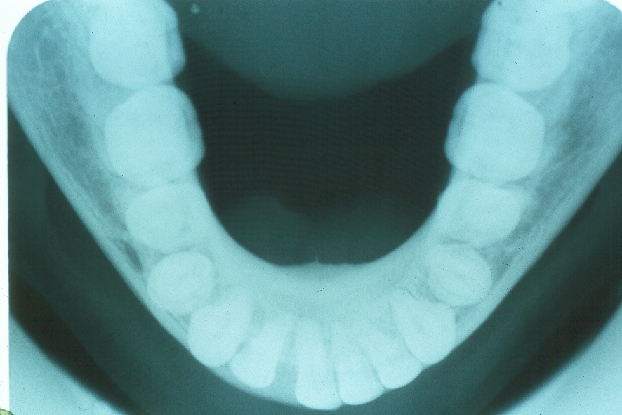 Figura 3