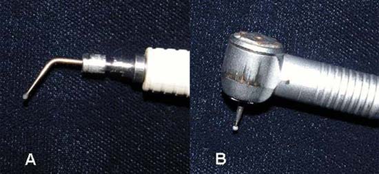 Figura 1: (A) Punta diamantada CVD ultrasónica acoplada a un equipo de ultrasonido. (B) Punta diamantada convencional en una pieza de alta rotación.