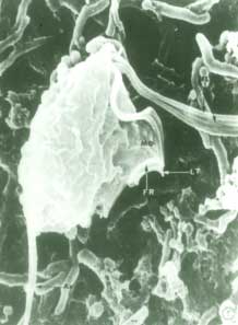 FIGURA 1: T. tenax en microscopio electrónico de barrido. Se distinguen los principales organelos: -FL: Flagelos libres; -Ax: Axostilo; -MO: Membrana ondulante; -LT: Lámina terminal de la membrana ondulante (X 26.000). Tomado de Ribaux14.
