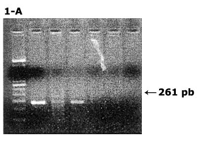 Carril 1: Marcador de Peso Molecular lambda leader 100 pb Carril 2: Control positivo Carril 4: Muestra de saliva positiva para VHC Carril 3, 5, 6: Muestra de saliva negativas para VHC Carril 7: Control negativo