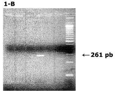 Carril 1: Marcador de Peso Molecular lambda leader 100 pb Carril 4: Muestra de saliva positiva para VHC Carril 2, 3, 5, 6, 7: Muestra negativa