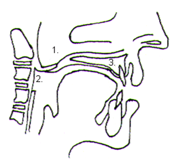 Figura N°4.1. Paladar blando, 2. Colgajo de mucosa faríngea de base superior, 3. Paladar óseo