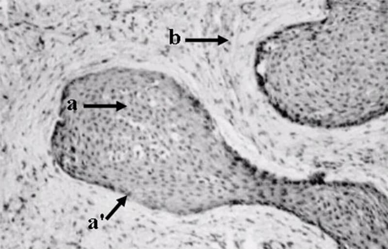 Figura 2 – Aspecto histológico a- isla epitelial; a’ - capa externa de células cuboides aplanadas; b – tejido conjuntivo Fuente: Sapp, 1997