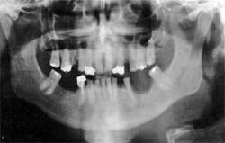 Fig. 2 Imagen radiográfica.