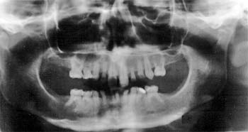 Fig. 3 Radiografía panorámica