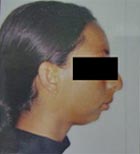 FIG. 2 Perfil derecho