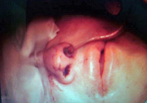 Fig. 4