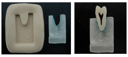 Figura 2 Confección del ligamento periodontal simulado