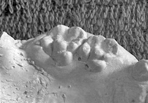 Figura 13. Cúspide de Carabelli segundo molar superior temporal y primer molar superior permanente expresión cúspide.