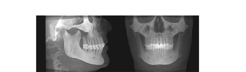 Fig. 6 Imágenes de reconstrución en 3D del aparato I-CAT.