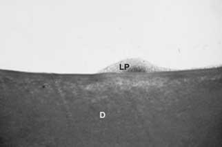 Fig: 2 Grupo II: Remanente del ligamento periodontal junto a la superficie radicular. Tricromico de Masson - 160x.