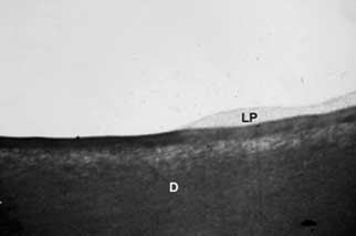 Fig: 5 Grupo II: Remanente del ligamento periodontal después de la fricción de la superficie a radicular. Tricromico de Masson - 63x.