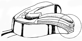 Figura 4 Diagrama que muestra la relación entre la impresión final, el borde de hidrocoloide irreversible y la cubeta metálica. Tomado de Chen et al, 1987.