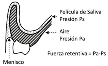 Figura 2 Retención debida al diferencial de presión entre la película de saliva y el aire Tomado de Basker RM, Davenport JC 2