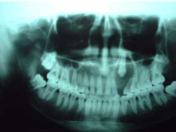 Fig.2