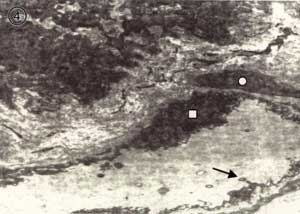 Fig. 4: Corion adyacente al epitelio. Cuadrado: núcleo endothelial; circulo: pericito; flecha: proyecciones endoteliales. 10500x.