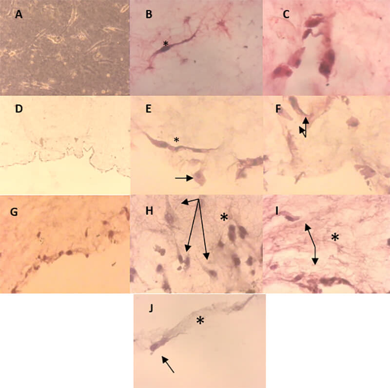 FIGURA 4. Células mesenquimales de la pulpa dentaria humana sobre la matriz de colágeno tipo I. A. Tres días de cultivo, células viables, con morfología fusiforme. 100x. Contraste de fase. Catorce y veintiún días de inducción odontogénica-osteogénica. Coloración Hematoxilina-Eosina. Catorce días: B. Cultivo “control”, célula fusiforme (*). 400x. C. Cultivo “inducido a la diferenciación”, células con cambios morfológicos. 400x. Veintiún días: Cultivo “control”: D. Células sobre la matriz. 40x. E. Células fusiformes (*) y otras con cambios morfológicos (flecha). 400x. F. Algunas células polarizadas, (flechas). 400x. Cultivo “inducido a la diferenciación”: G. Células sobre la matriz y algunas incluidas con cambios morfológicos. 100x. H. I. y J. Células polarizadas con prolongación citoplasmática, semejantes a odontoblastos (flechas), la matriz se observa fibrosa y densa (*). 400x