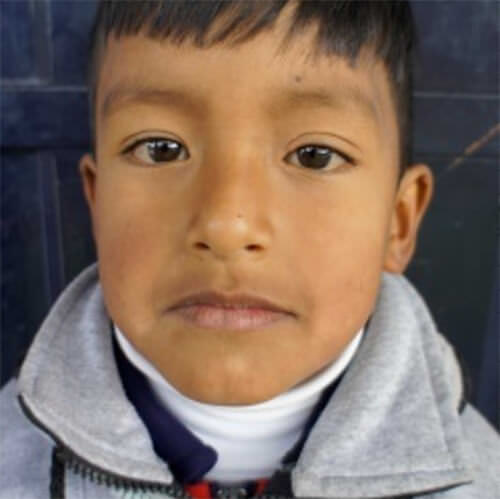 Figura 1. Paciente #1