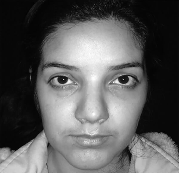 Figura 8: Fotografìa frontal Fuente: Propia