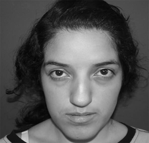 Figura 2: Fotografia frontal Fuente: Propia