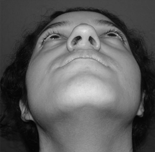 Figura 3: Fotografía Caudocefalica Fuente: Propia