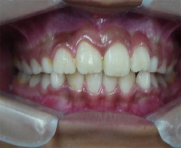 Fig. 3b