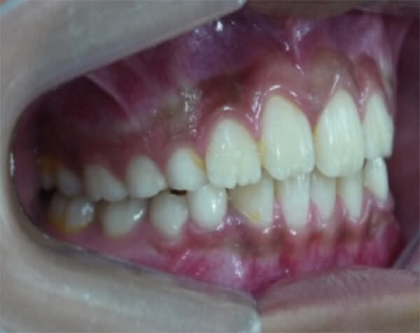 Fig. 3c