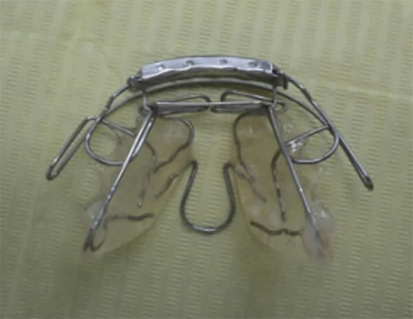 Fig. 4c