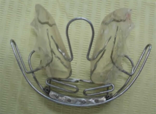 Fig. 4d