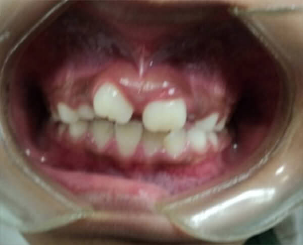 Fig. 1b