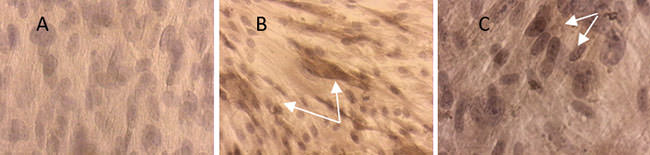 FIGURA 1 Diferenciación odontogénica-osteogénica de las células mesenquimales de la pulpa dentaria humana, cultivo en monocapa. Expresión inmunocitoquímica de la DSP (Coloración marrón). Catorce días de inducción. A. Cultivo "control", no hay expresión. 400x. B. Cultivo "inducido a la diferenciación odontogénica-osteogénica", expresión moderada e intensa de la DSP (flechas). 200x. C. Detalle de las células que expresan la DSP (flechas). 400x