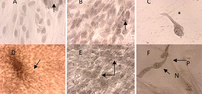 FIGURA 2 Diferenciación odontogénica-osteogénica de las células mesenquimales de pulpa dentaria humana, cultivo en monocapa. Expresión inmunocitoquímica de la DSP y cambios morfológicos de las células. Veintiún días de inducción. Cultivo "control": A. y B. Algunas células expresan leve y moderado DSP+ (flechas). 400x. C. Cambios morfológicos, célula semejante a odontoblasto (*). 400x. Cultivo "inducido a la diferenciación odontogénica-osteogénica": D. Agregado celular DSP+ (flecha). 40x. E. Mayor aumento, células y matriz expresan DSP+ (flechas). 200x. F. Células con morfología semejante a odontoblastos, núcleo polarizado (N), proceso odontoblástico alargado (P), expresan DSP+.