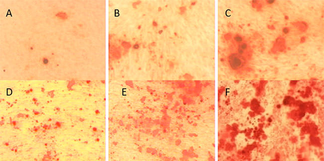FIGURA 3 Diferenciación odontogénica-osteogénica de las células mesenquimales de pulpa dentaria humana, cultivo en monocapa. Formación de nódulos calcificados, coloración histoquímica con Rojo Alizarina. Catorce días: A. Cultivo "control", se observa la formación de muy pocos y pequeños nódulos. 100x. B. Cultivo "inducido a la diferenciación odontogénica-osteogénica", formación de mayor número de nódulos calcificados y de mayor tamaño. 40x. C. Características de estos nódulos a mayor aumento.100x. Veintiún días: D. Cultivo "control", se observan numerosos nódulos calcificados. 100x. E. Cultivo "inducido a la diferenciación odontogénica-osteogénica", numerosos nódulos pequeños, grandes y zonas difusas de mineralización. 100x. F. Mayor detalle de estos nódulos y zonas de mineralización. 200x.