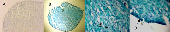 FIGURA 6 Inducción a la diferenciación condrogénica de las células mesenquimales de la pulpa dentaria humana, por tres semanas. Coloración histoquímica con Azul Alcián pH 2,5. A. Cultivo "control": la micromasa, fue "negativa" a la coloración histoquímica con el Azul Alcián. 100x. B. Cultivo "inducido a la diferenciación": la micromasa, fue "positiva" a la coloración con el Azul Alcián. 40x. C. Zona central, se detalla la matriz extracelular coloreada con el Azul Alcian(*) que revela la producción de glicosaminoglicanos sulfatados componente de la matriz de cartílago y los núcleos de las células (flecha).400x. D. Periferia de la micromasa, coloreada azul intenso, se observan células fusiformes cortas que rodean la micromasa semejante al "pericondrio". 400x. (flechas)