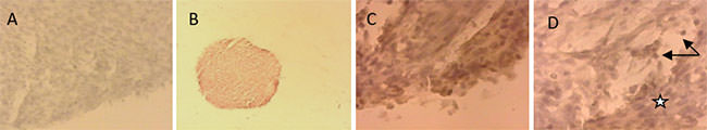 FIGURA 7 Inducción a la diferenciación condrogénica de las células mesenquimales de la pulpa dentaria humana, por tres semanas. Expresión del anticuerpo anticolágeno tipo II, prueba inmunohistoquímica (coloración marrón). A. Cultivo "control", el anticuerpo no se expresa. 200x. B. Cultivo "inducido a la diferenciación", agregado o micromasa. 40x. C. Mayor aumento, zona periférica expresión positiva en algunas células y en la matriz extracelular. 400x. D. Zona central, algunas células (flechas) y zonas de la matriz ( ) expresan el anticuerpo anticolágeno tipo II. 400x
