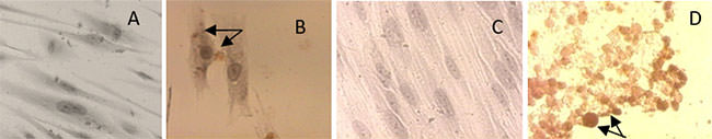 FIGURA 8 Inducción a la diferenciación adipogénica de las células mesenquimales de la pulpa dentaria humana cultivadas en monocapa. Una semana: A. Cultivo "control": células con morfología fusiforme, núcleo ovalado y central, varios nucléolos y delgadas prolongaciones citoplasmáticas. 400x. B. Cultivo "inducido": células tratadas con suplementos adipogénicos por una semana, presentan características de preadipocitos, células con morfología poligonal con gotas de lípido en el citoplasma coloreadas con Sudan III, (flechas). 400x. Tres semanas. C. Cultivo "control", células fusiformes, con morfología típica de fibroblastos. 400x. D. Células "inducidas a la diferenciación adipogénica", las células tienen una forma esférica, algunas positivas a la coloración histoquímica con Sudan III (flechas). 400x