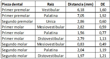 Tabla I Distancia de los ápices de dientes postero-superiores al seno maxilar.